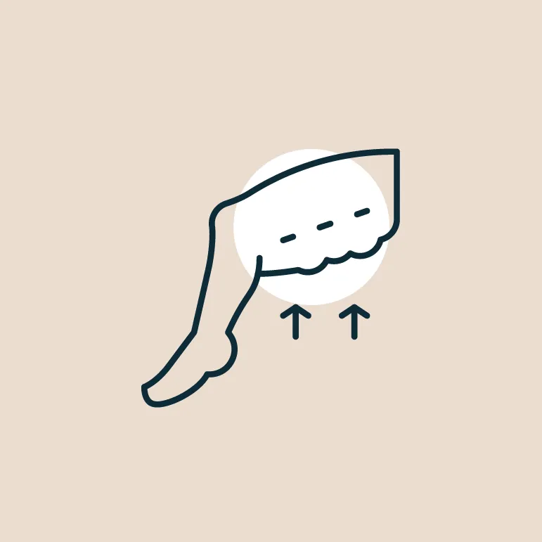 Lipedema Treatment